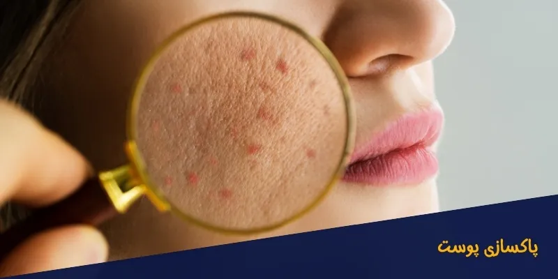 فواید-سونا-بخار-برای-پاکسازی-پوست فواید سونا بخار برای پاکسازی پوست